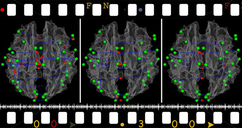 Neuroimaging and movie trailers cluster
